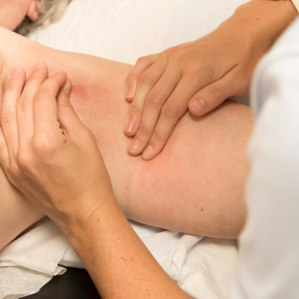 photo of woman receiving a massage for lymphedema